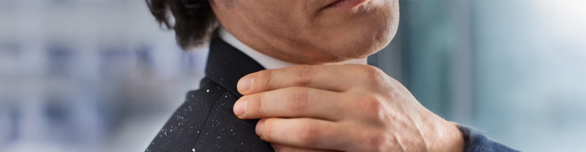 Caspa e stress – dicas para controlar o stress